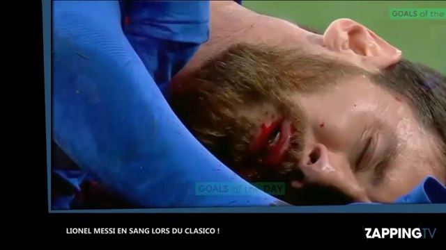 Lionel Messi le visage en sang après un coup de coude de Marcelo lors du Clasico (Vidéo)
