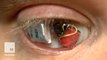 This self-proclaimed cyborg turned his prosthetic eye into a tiny camera