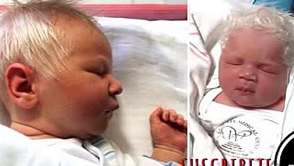 Niño Nace con el Pelo Blanco Pero Cuando el medico cuenta La Verdad, La Mama se queda sin Habla!