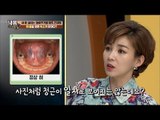 혀 밑을 보면 나의 혈액 오염 정도를 알 수 있다! [내 몸 사용설명서] 131회 20161202