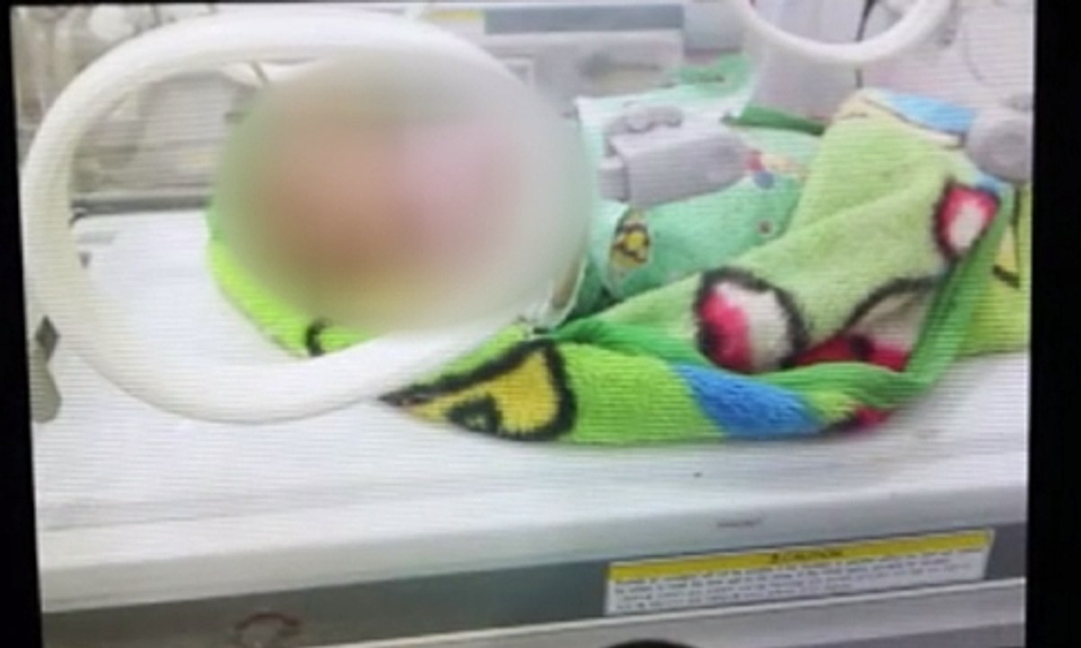 Bayi Ini Dilempar Sang Ayah ke Tungku Api