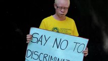 Why does albinism occur?