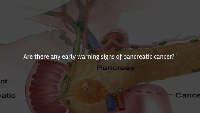 early warning signs of pancreatic cancer