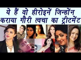 Top Bollywood Actresses who went for Skin Lightening Treatment | Filmibeat