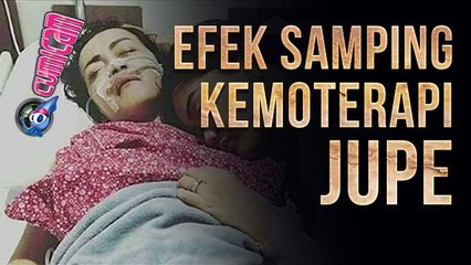 Inilah Efek Samping Kemoterapi yang Dialami Jupe - Cumicam 25 April 2017