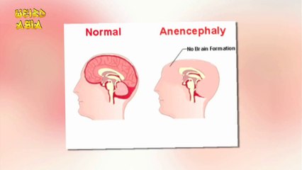 5 Weird Birth Defects | Weird Asia