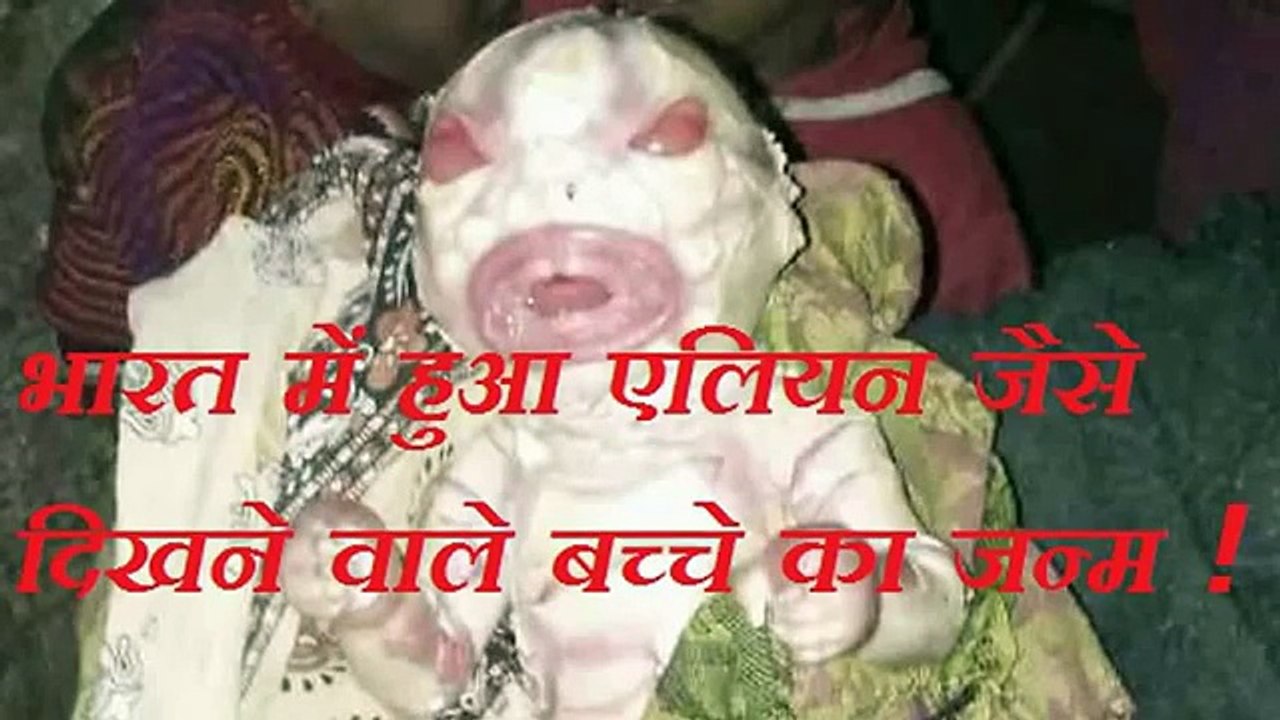 Freaky Funtoosh Video: OMG Alien like baby born in bihar india
