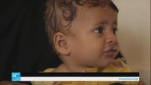 مخاوف أممية من مجاعة في اليمن