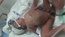 Un enfant naît avec 4 jambes et 2 pénis
