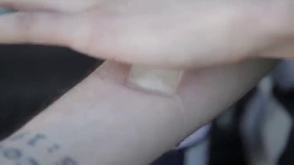 Le Ice and Salt Challenge, un défi débile qui provoque de graves blessures