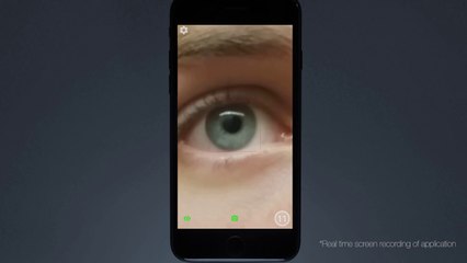 Esta aplicación detecta la conmoción cerebral en segundos