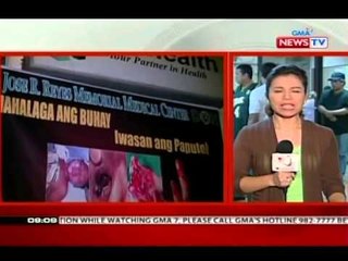SONA: Mga ospital, naghahanda na para sa mga mabibiktima ng paputok ngayong bagong taon