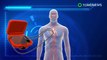Robot pembungkus jantung ini dapat membantu detak jantung anda - Tomonews