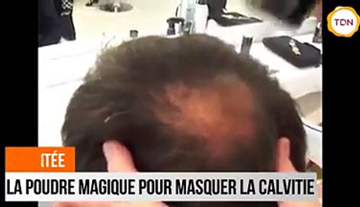 Grâce à Densitée, plus personne ne verra le dessus de votre crâne !