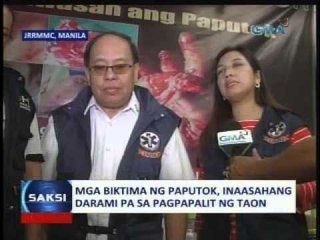 Saksi: Mga biktima ng paputok, inaasahang darami pa sa pagpapalit ng taon