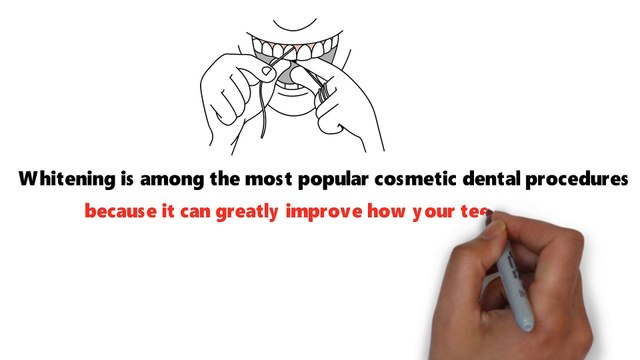 Do Teeth Whitening Strips Work?