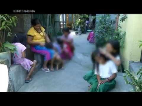 Kids in Malabon barangay infested with head lice | Brigada