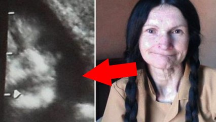 FANTASMAS EM ULTRASSONOGRAFIAS CASOS REAIS