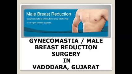 Gynecomastia surgery in Vadodara, Gujarat