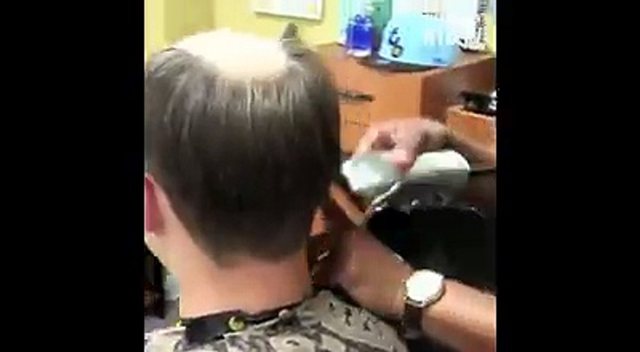 Me këtë metodë më nuk do jeni tullac