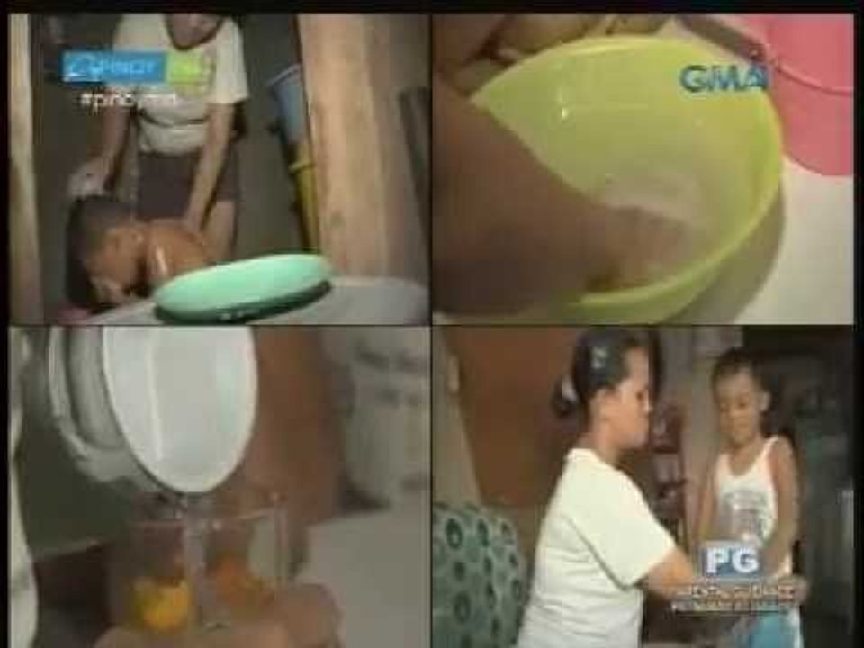 How to get rid of lice, prickly heat | Pinoy MD