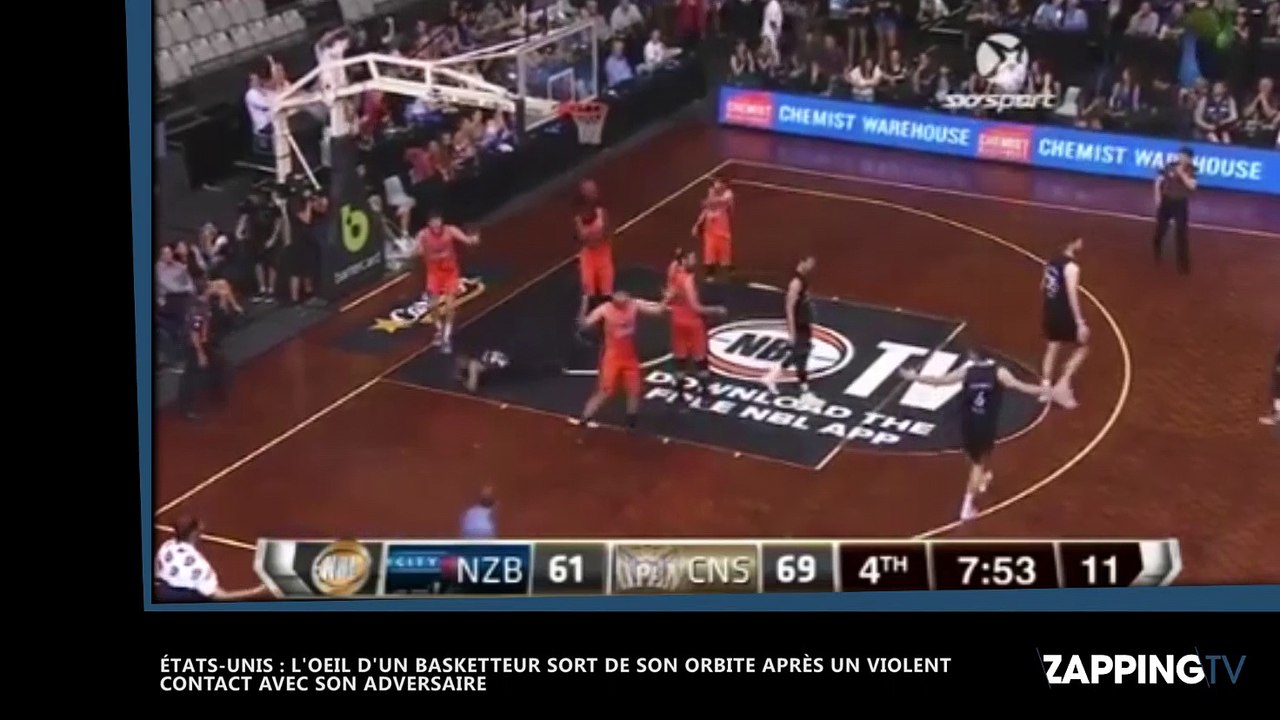 L'oeil d'un basketteur sort de son orbite lors d'un match (vidéo)