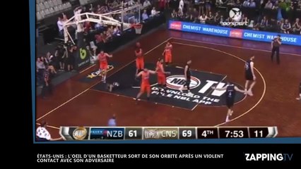 L'oeil d'un basketteur sort de son orbite lors d'un match (vidéo)