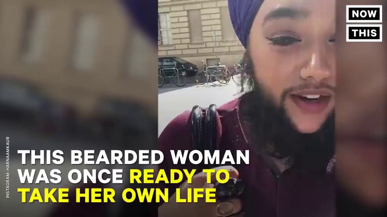 This Bearded Woman was once ready to take her Own Life