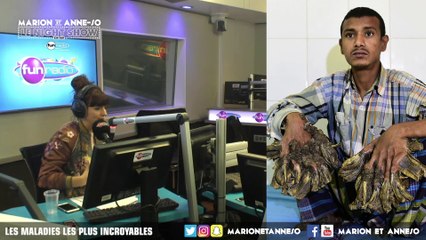 LES MALADIES LES PLUS INCROYABLES ! - Marion et Anne-So