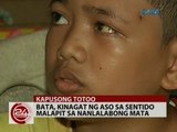 24Oras: Bata, kinagat ng aso sa sentido malapit sa nanlalabong mata