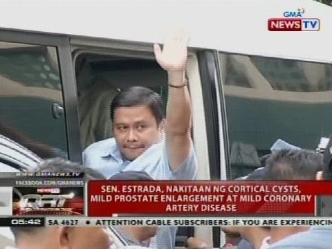 Sen. Estrada, nakitaan ng cortical cysts, mild prostate enlargement at mild coronary artery disease