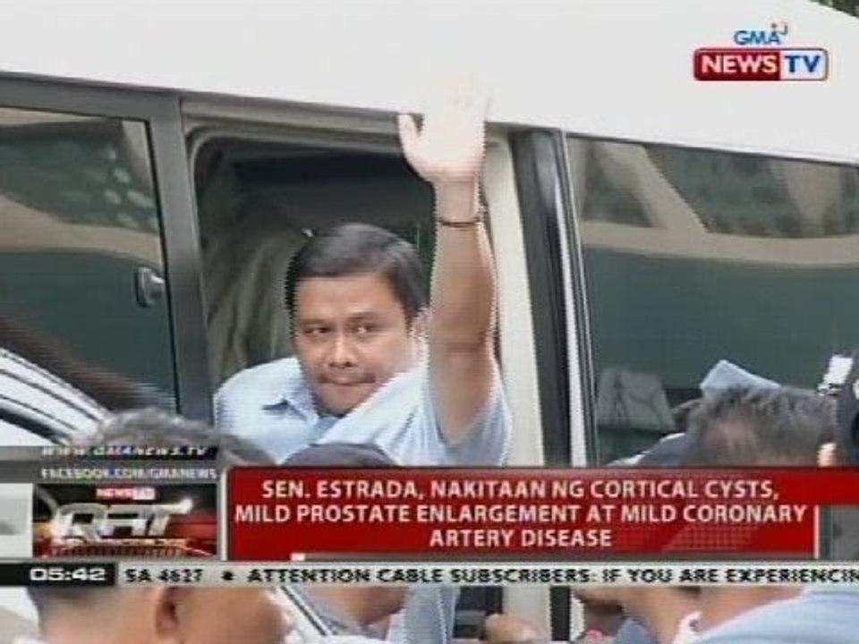 Sen. Estrada, nakitaan ng cortical cysts, mild prostate enlargement at mild coronary artery disease