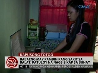 24Oras: Babaeng may pambihirang sakit sa balat, patuloy na nagsisikap sa buhay