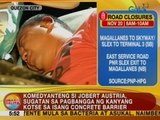 UB: Komedyanteng si Jobert Austria, sugatan sa aksidente sa daan