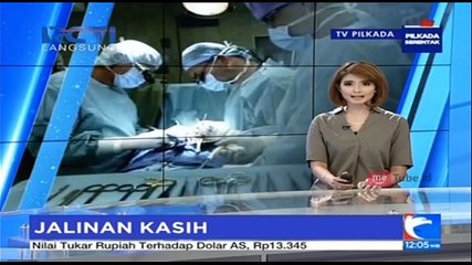 Yayasan Jalinan Kasih Gelar Operasi Gratis Bibir Sumbing