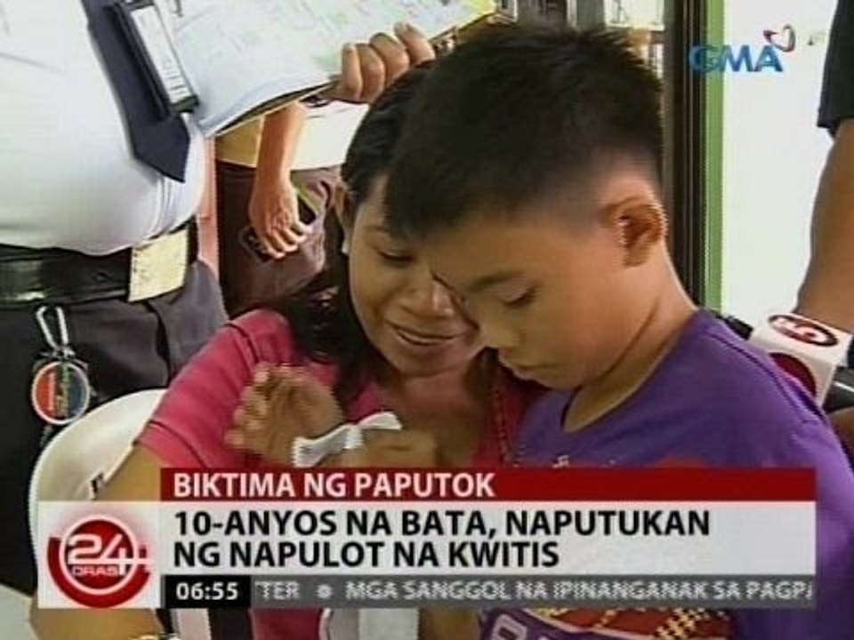 24Oras: 10-anyos na bata, naputukan ng napulot na kwitis