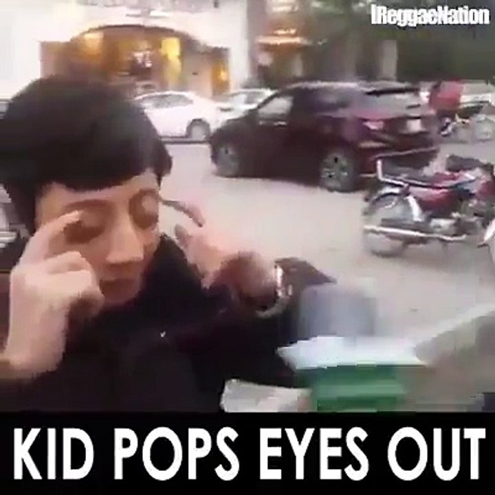 Kid pops eyes out