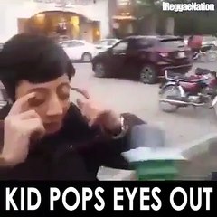Kid pops eyes out