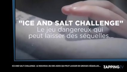 Le "ice and salt challenge", le nouveau jeu très dangereux des adolescents (Vidéo)