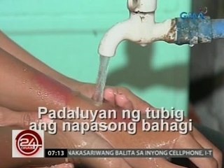 24 Oras: Mga dapat gawin sakaling magkapaso dahil sa sunog
