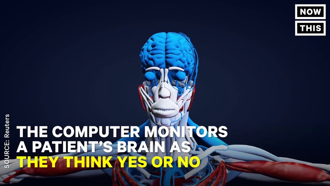 Scientists Have Made It Possible For People Who Are Completely Paralyzed To Communicate