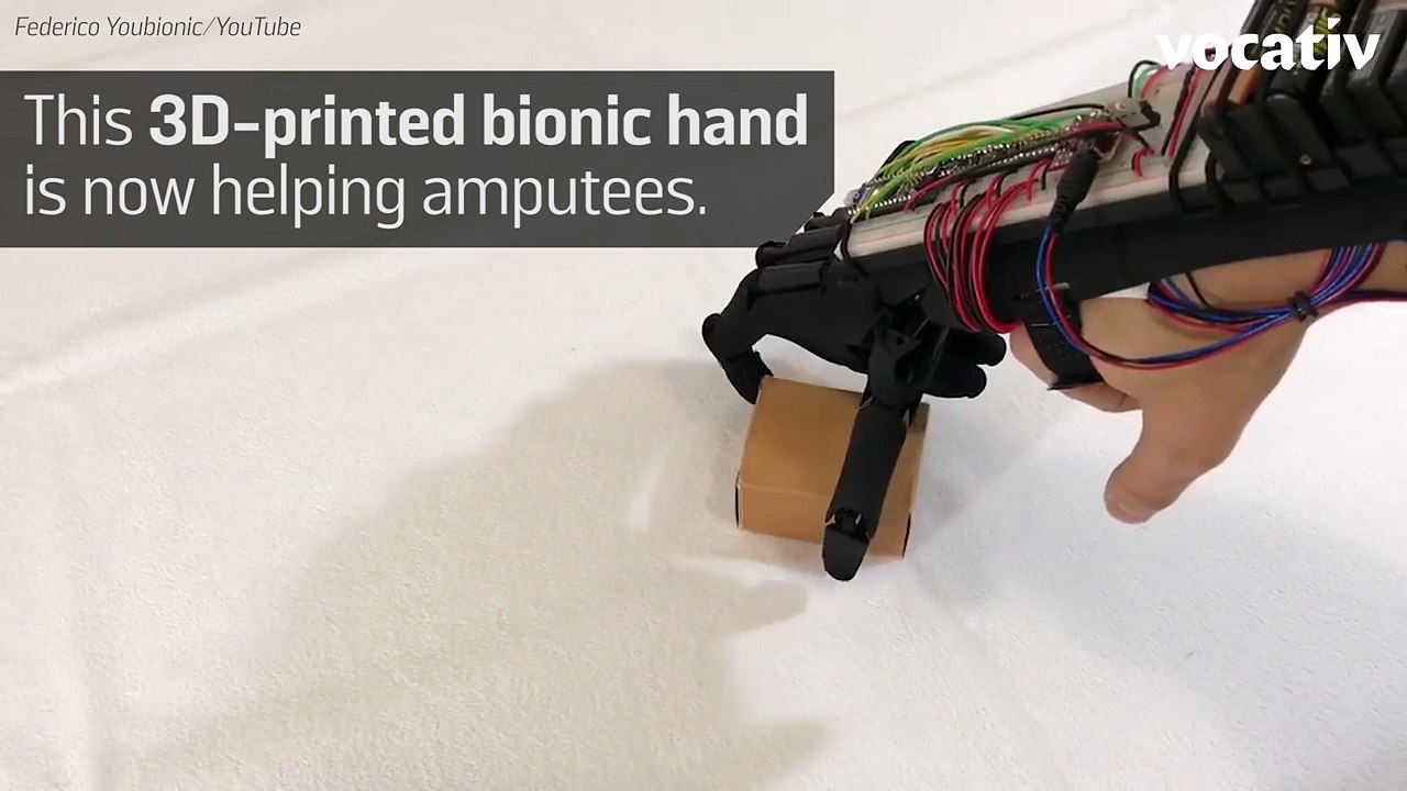 This Bionic Hand Is The First Module For A Full-Body Exoskeleton