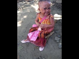 Batang may kakaibang sakit sa balat,  ipinasuri sa espesyalista