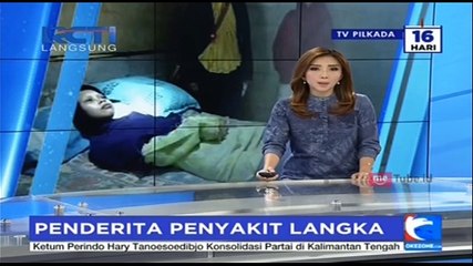 Penderita Peradangan Tulang Kembali Ditemukan di Sragen