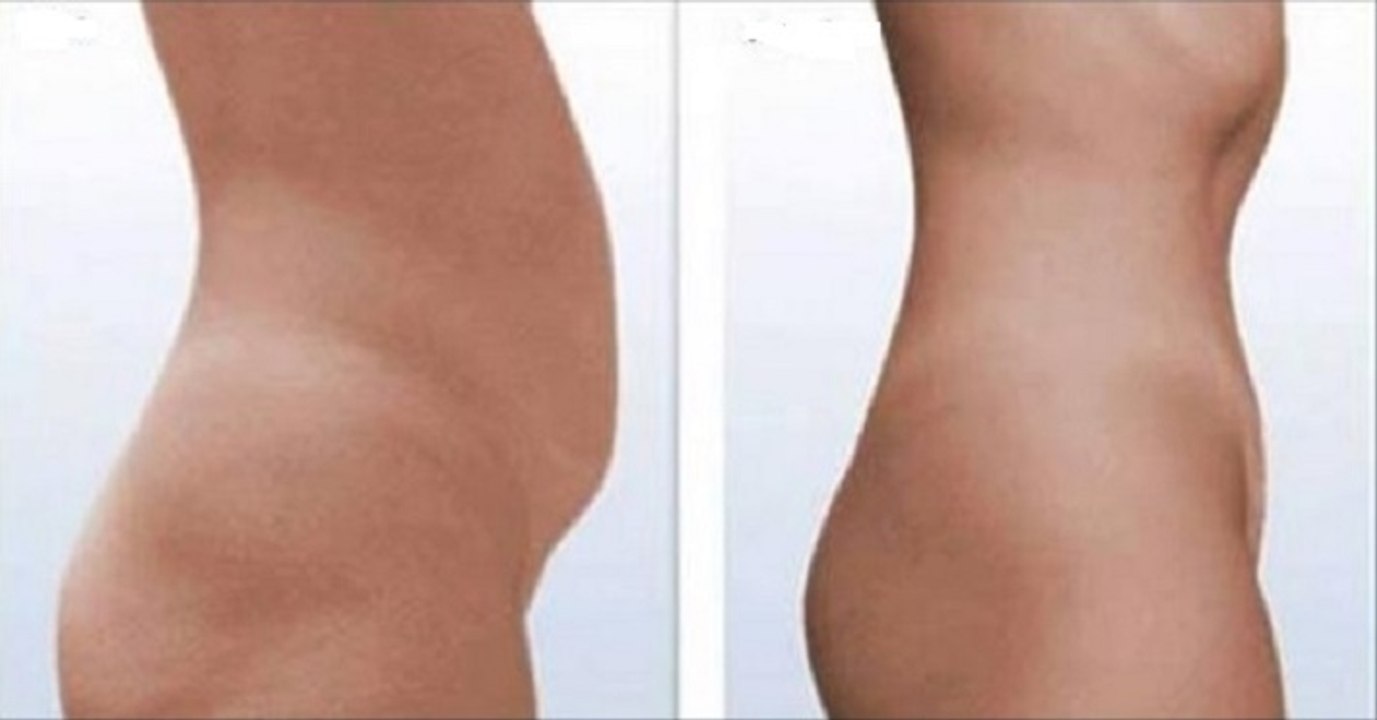 Fisioterapeuta Cria Método Que Está Fazer Sucesso Na Europa: Seca A Barriga Sem Exercícios!