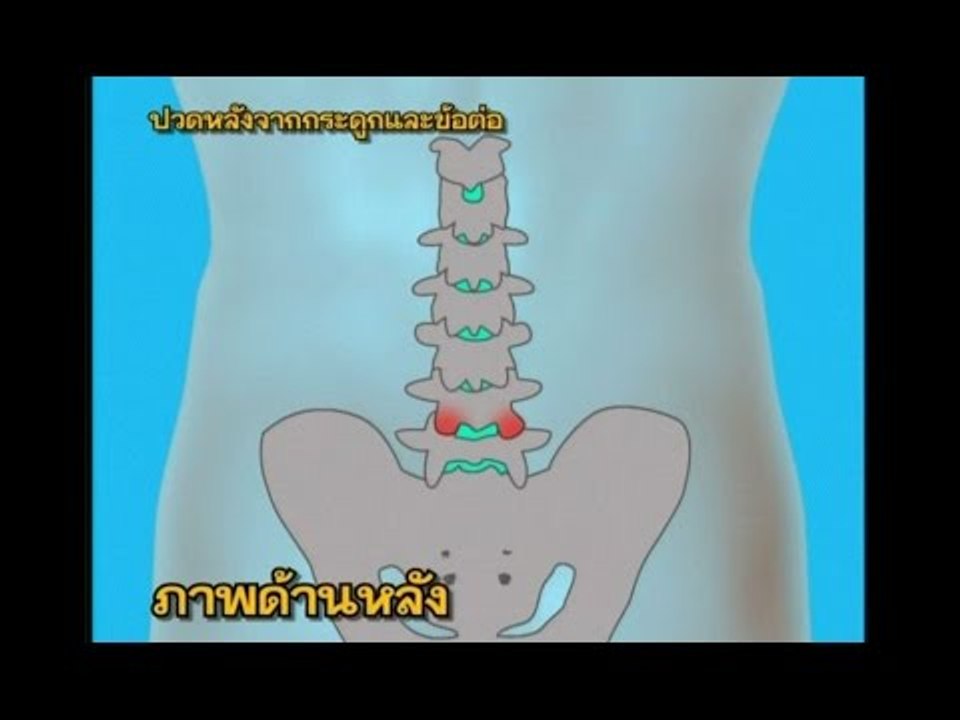 ชิดหมอ ..( Ep.42 ).. ตอน "ปวดหลัง"