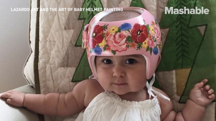 Woman turns babies' medical helmets into adorable works of art