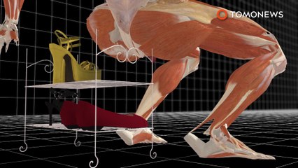 Woman ‘slut drops’ onto metal pole and has to get stitches on her butt