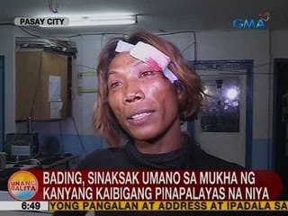 UB: Bading, sinaksak umano sa mukha ng kanyang kaibigang pinapalayas na niya
