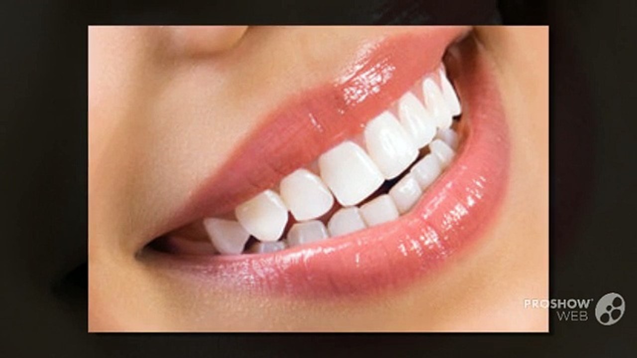 Coventry Teeth Whitening